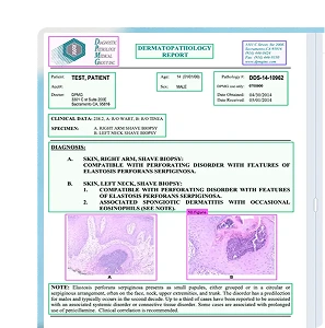 Complex Layout Extraction