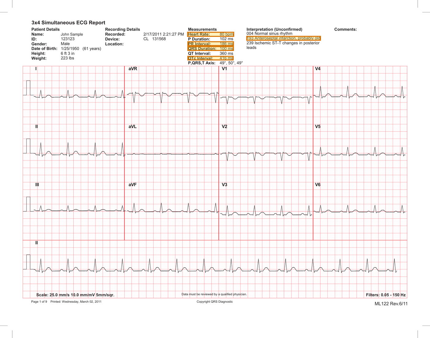 Page 1 of a sample EKG Report, with extracted values outlined
