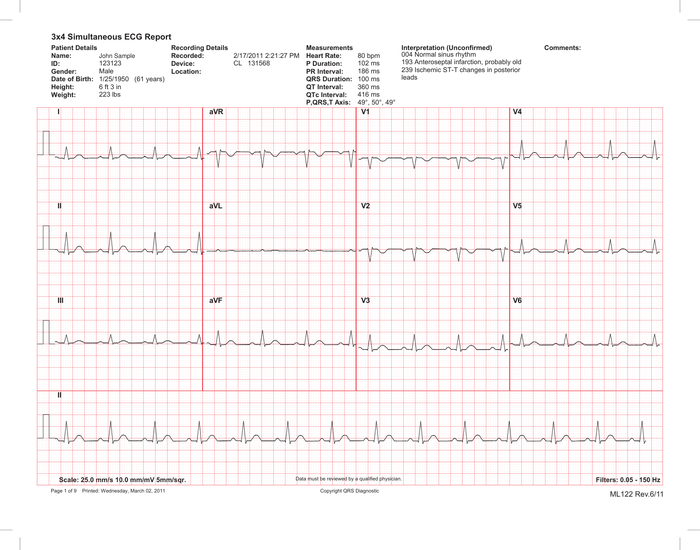 Page 1 of the sample EKG Report
