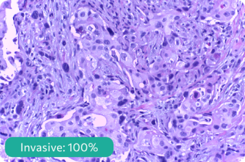 Histopathology and Cancer Detection
