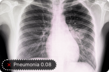 Detect and Diagnose in Medical Imaging