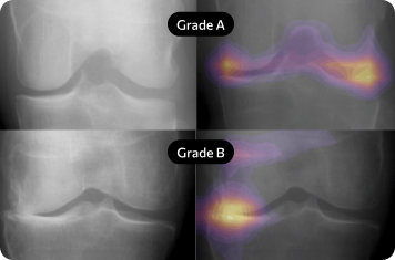 Diagnose Stages of Disease