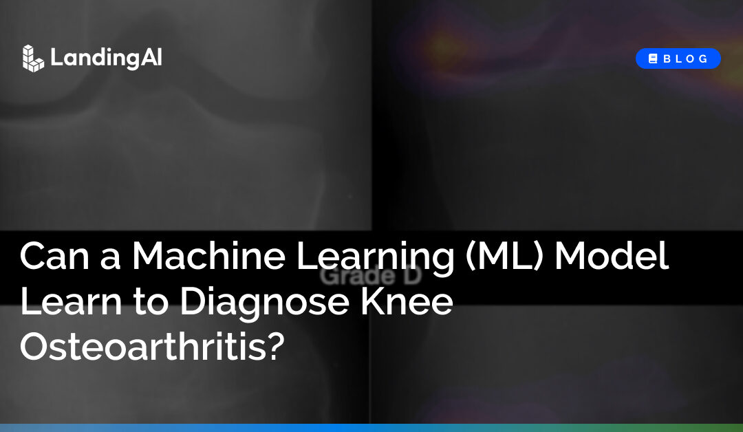 Can a Machine Learning (ML) Model Learn to Diagnose Knee Osteoarthritis?