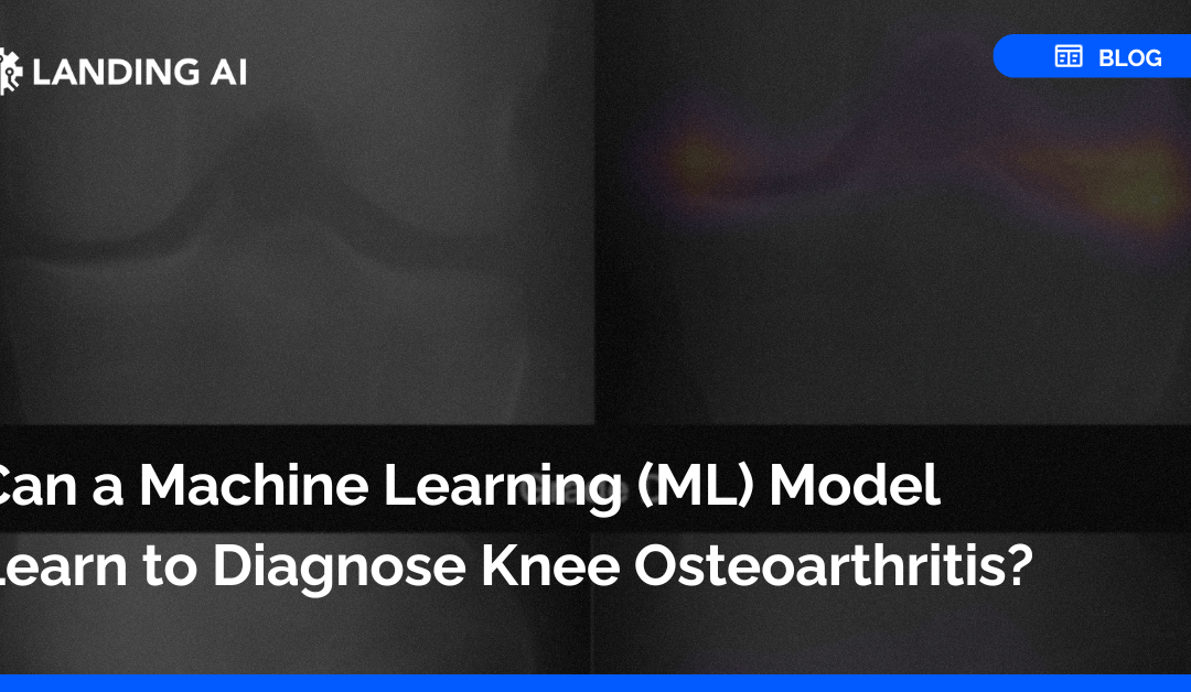 Can a Machine Learning (ML) Model Learn to Diagnose Knee Osteoarthritis?
